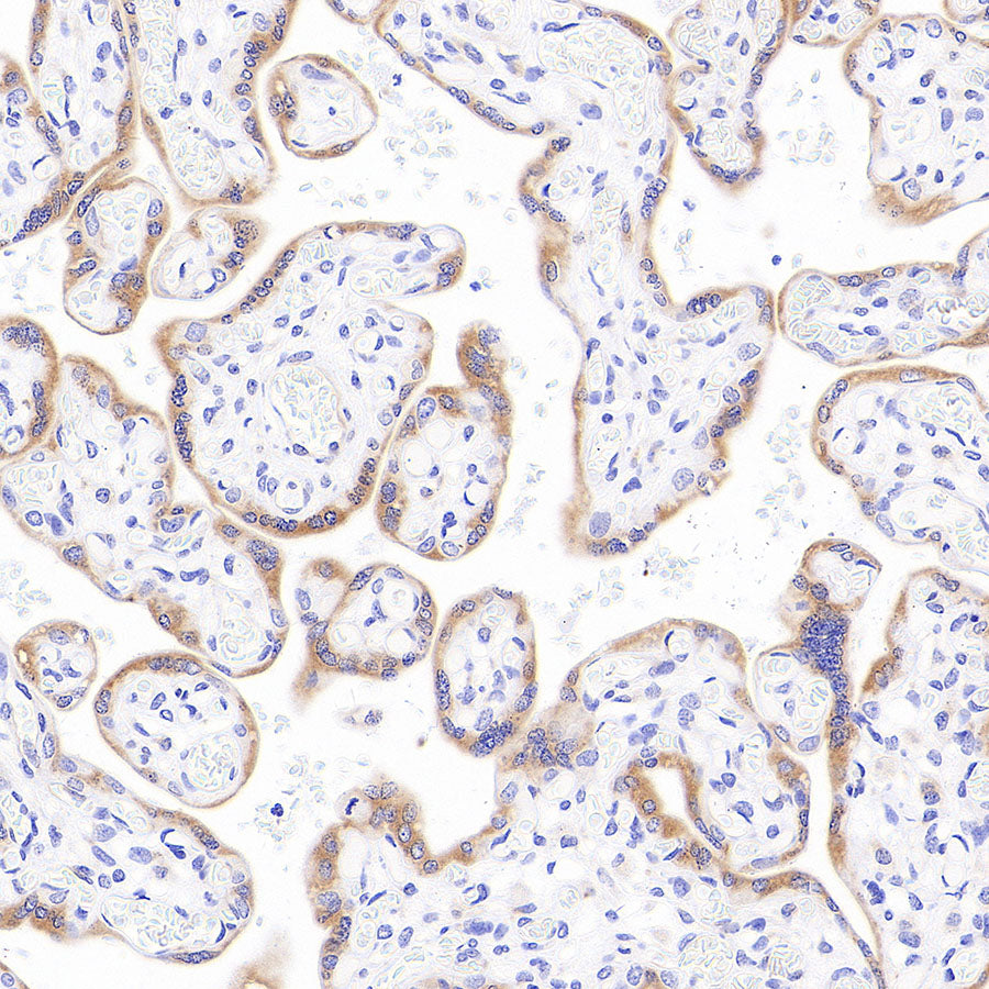 SPTLC1 Recombinant Rabbit mAb (S-6028)