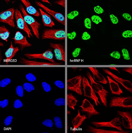 hnRNP H Rabbit Polyclonal Antibody