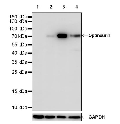 Optineurin Recombinant Rabbit mAb (S-2030-40)