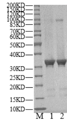 RSK2 Protein, Human