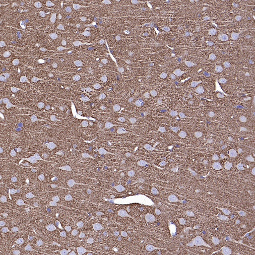 GAP43 Rabbit Polyclonal Antibody-Neuronal Marker