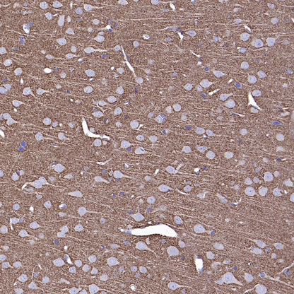 GAP43 Rabbit Polyclonal Antibody-Neuronal Marker