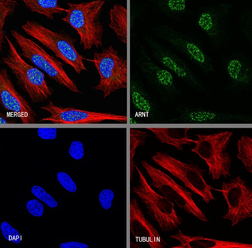 ARNT Recombinant Rabbit mAb (S-2263-43)