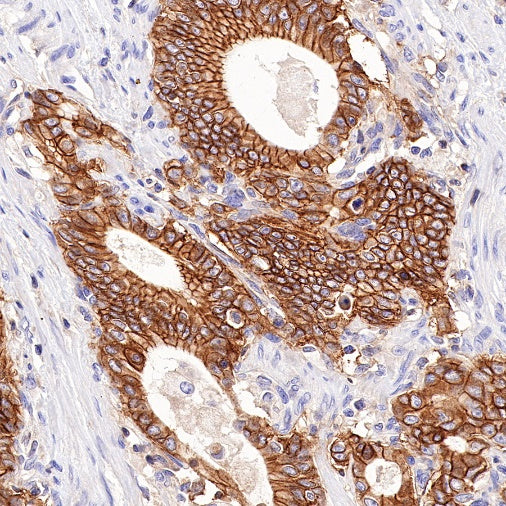 CD46 Recombinant Rabbit mAb (S-668-119)