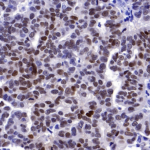 ER alpha Recombinant Rabbit mAb (SDT-2950-36)