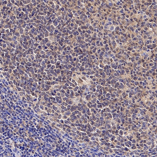 SMAD2 Recombinant Rabbit mAb (S-1420-20)