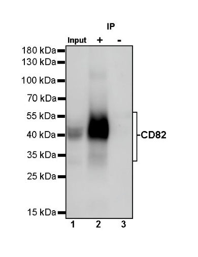 CD82 Recombinant Rabbit mAb (S-673-44)