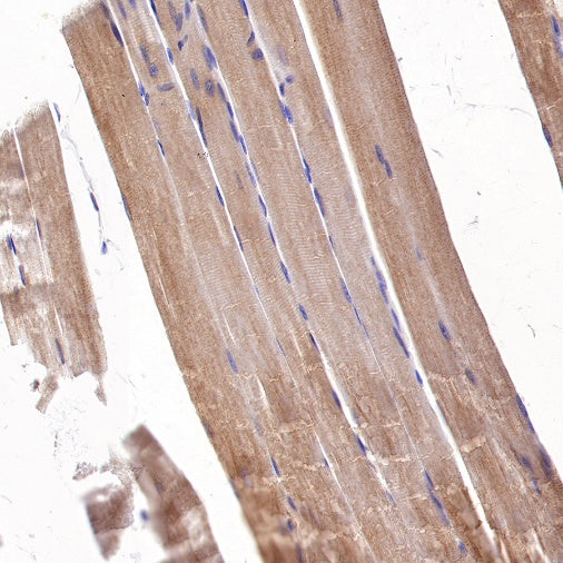 Trim30a Recombinant Rabbit mAb (S-1753-35)