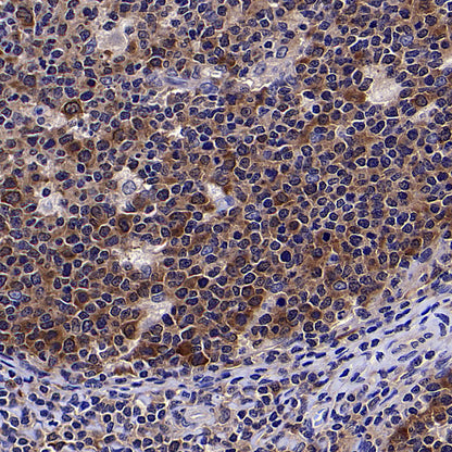 HSP90 Recombinant Mouse mAb (S-5484)