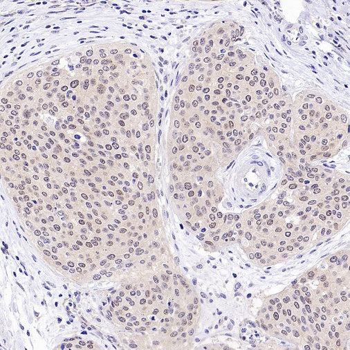 Caspase-2 Recombinant Rabbit mAb (S-3188-3)