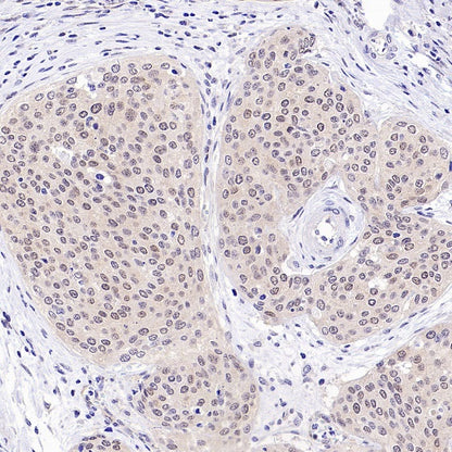 Caspase-2 Recombinant Rabbit mAb (S-3188-3)