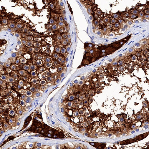 ACE2 Recombinant Rabbit mAb (S-1348-7)
