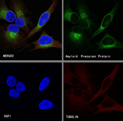 Amyloid Precursor Protein Recombinant Rabbit mAb (S-806-13)
