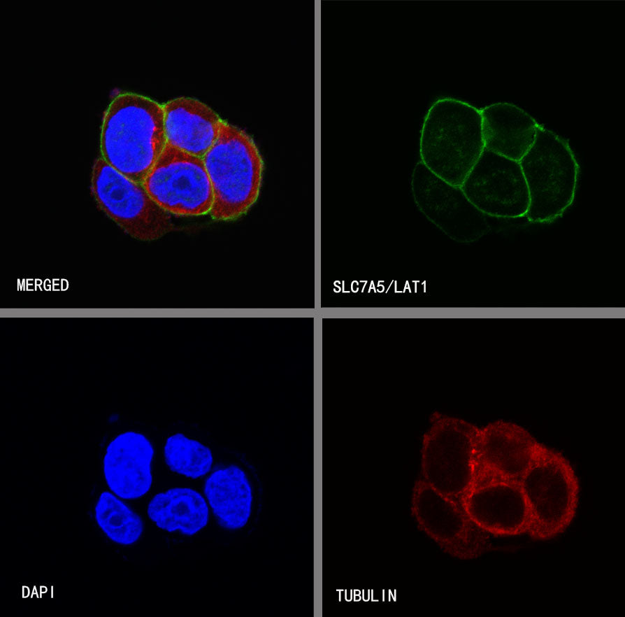 SLC7A5/LAT1 Recombinant Rabbit mAb (S-367-12)