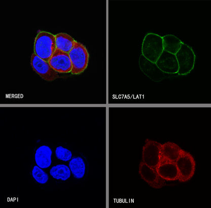 SLC7A5/LAT1 Recombinant Rabbit mAb (S-367-12)