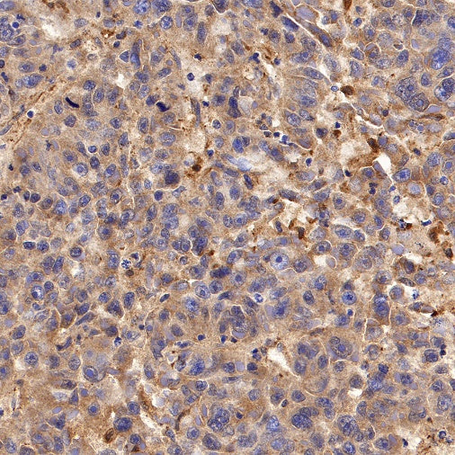 Glutathione Peroxidase 1 Recombinant Rabbit mAb (S-1714-17)