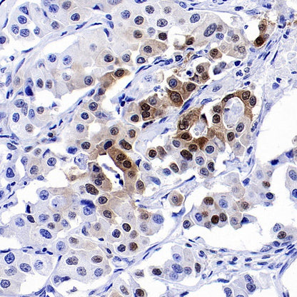 p27 Kip1 Recombinant Rabbit mAb (SDT-361-310)
