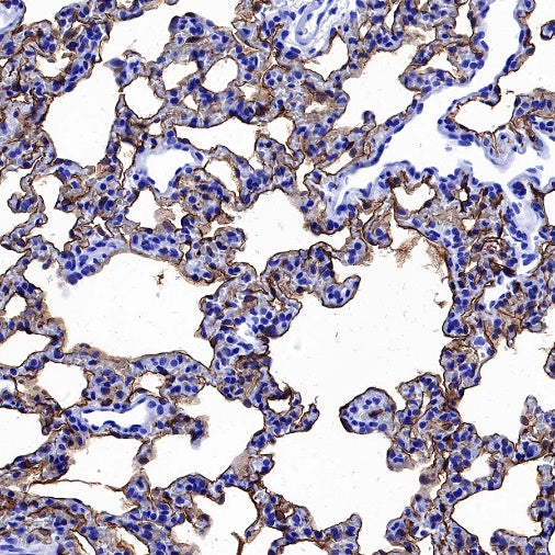 Aquaporin 5/AQP5 Recombinant Rabbit mAb (S-1610-43)