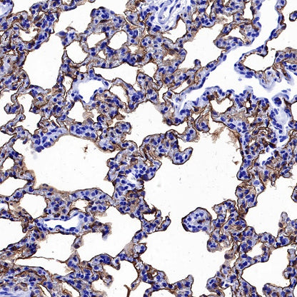 Aquaporin 5/AQP5 Recombinant Rabbit mAb (S-1610-43)