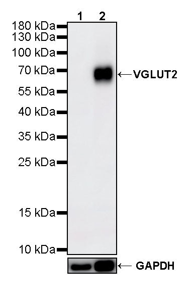 VGLUT2 Recombinant Rabbit mAb (S-4399-14)