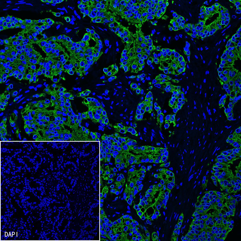 CK8/18 Recombinant Rabbit mAb,PBS Only (SDT-P005)