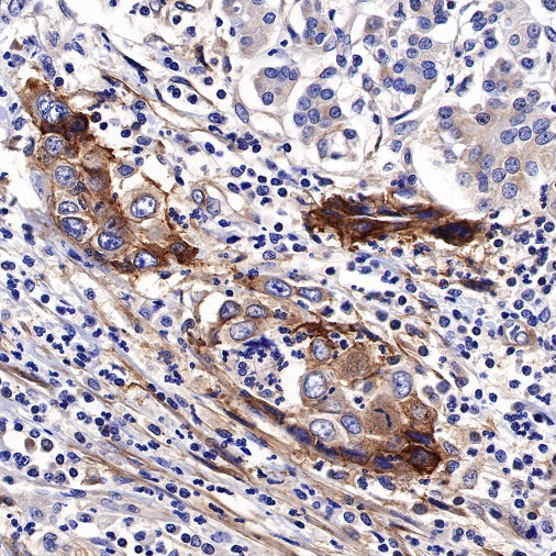 TWEAKR/FN14 Recombinant Rabbit mAb (S-913-1)