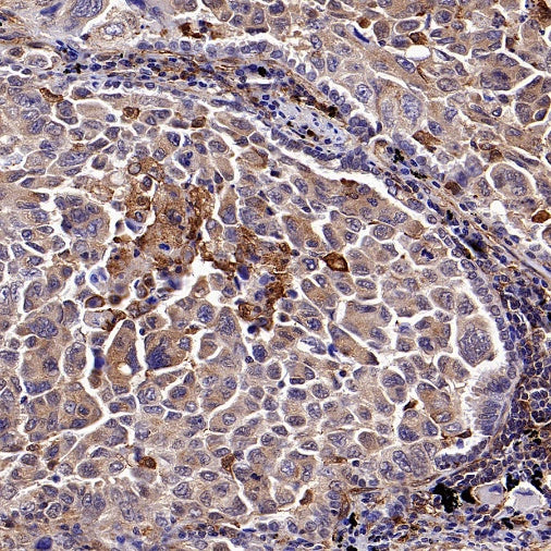 DAB2 Recombinant Rabbit mAb (S-2131-55)