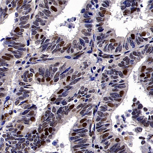 ERCC1 Recombinant Rabbit mAb,PBS Only (SDT-2458-29)