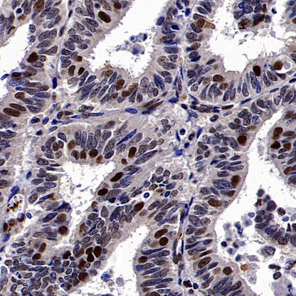 ERCC1 Recombinant Rabbit mAb,PBS Only (SDT-2458-29)
