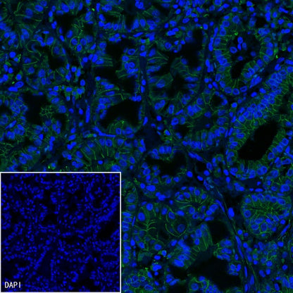 β-Catenin Recombinant Rabbit mAb (Alexa Fluor® 488 Conjugate) (S-336-23)