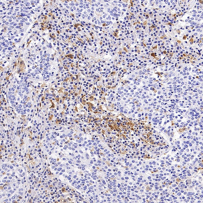 GBP5 Rabbit Polyclonal Antibody