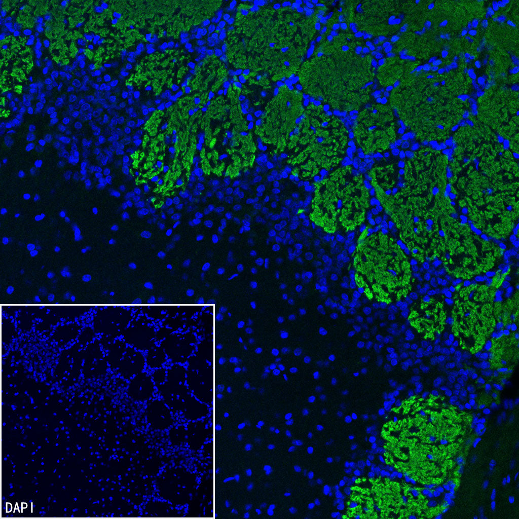 Olfactory Marker/OMP Recombinant Rabbit mAb (S-3513-32)