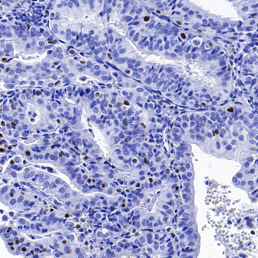 CEBPA Recombinant Rabbit mAb (S-3629-33)