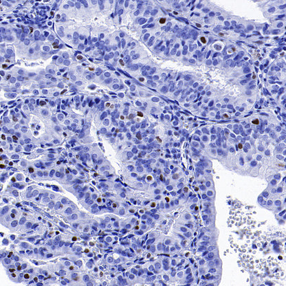 CEBPA Recombinant Rabbit mAb (S-3629-33)