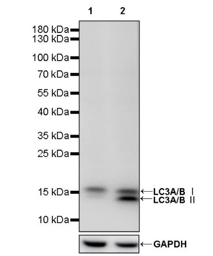 LC3A/B Recombinant Rabbit mAb (S-1367-104)