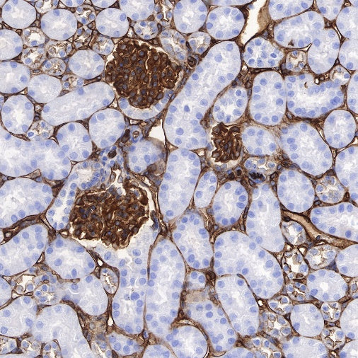S-RMab®Annexin A2 Recombinant Rabbit mAb (SDT-444-67)