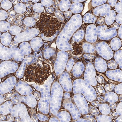 S-RMab®Annexin A2 Recombinant Rabbit mAb (SDT-444-67)