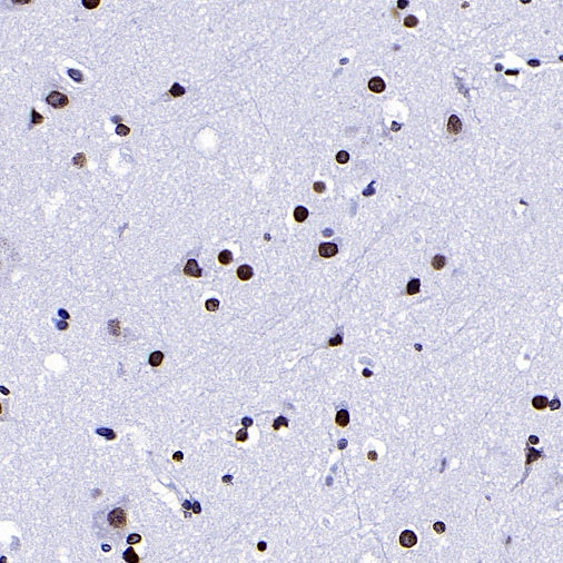 Histone H3 (di methyl K9) Recombinant Rabbit mAb (S-903-52)