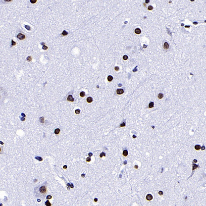 Histone H3 (di methyl K9) Recombinant Rabbit mAb (S-903-52)