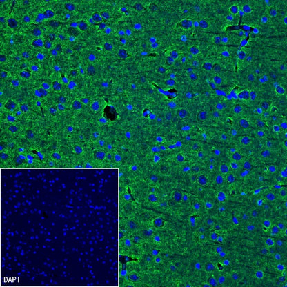 SNAP25 Recombinant Rabbit mAb (S-1828-67)