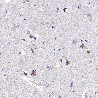 NDUFS8 Recombinant Rabbit mAb (S-1273-10)