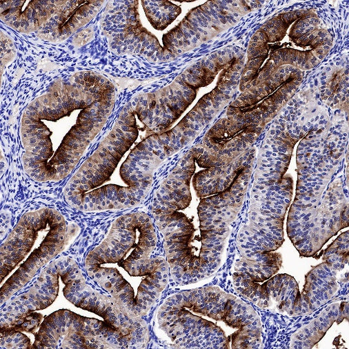 ENPP3/CD203c Recombinant Rabbit mAb (S-1632-11)