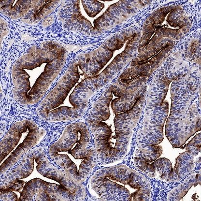 ENPP3/CD203c Recombinant Rabbit mAb (S-1632-11)