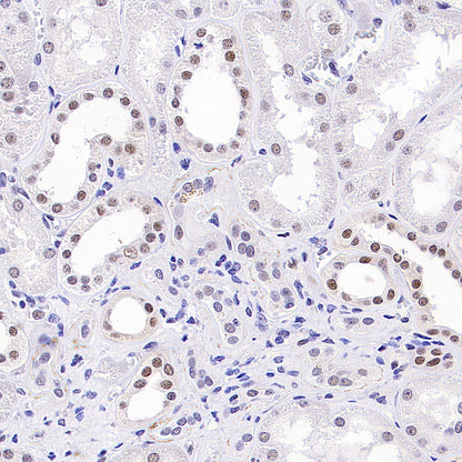 BRCA2 Recombinant Rabbit mAb (S-5306)