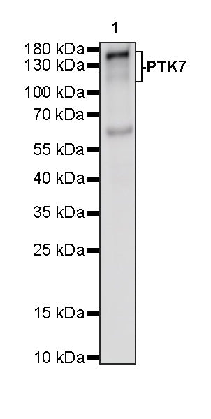 PTK7 Recombinant Rabbit mAb (SDT-2432-136)