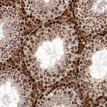 SMARCD1 Rabbit Polyclonal Antibody