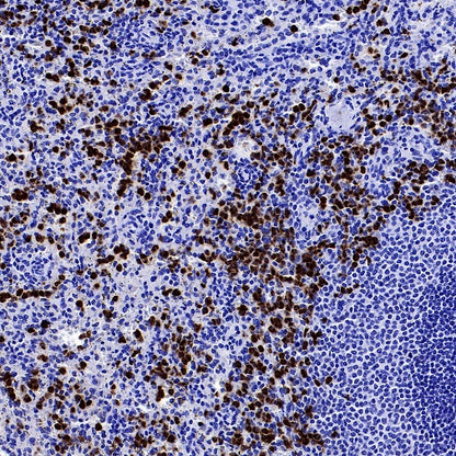 Lipocalin-2/NGAL Recombinant Rabbit mAb (S-2279-72)