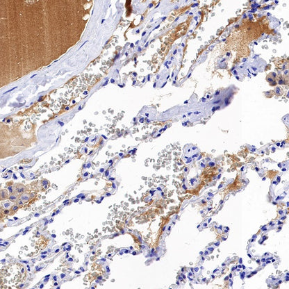 C1QB Recombinant Rabbit mAb (S-1248-314)