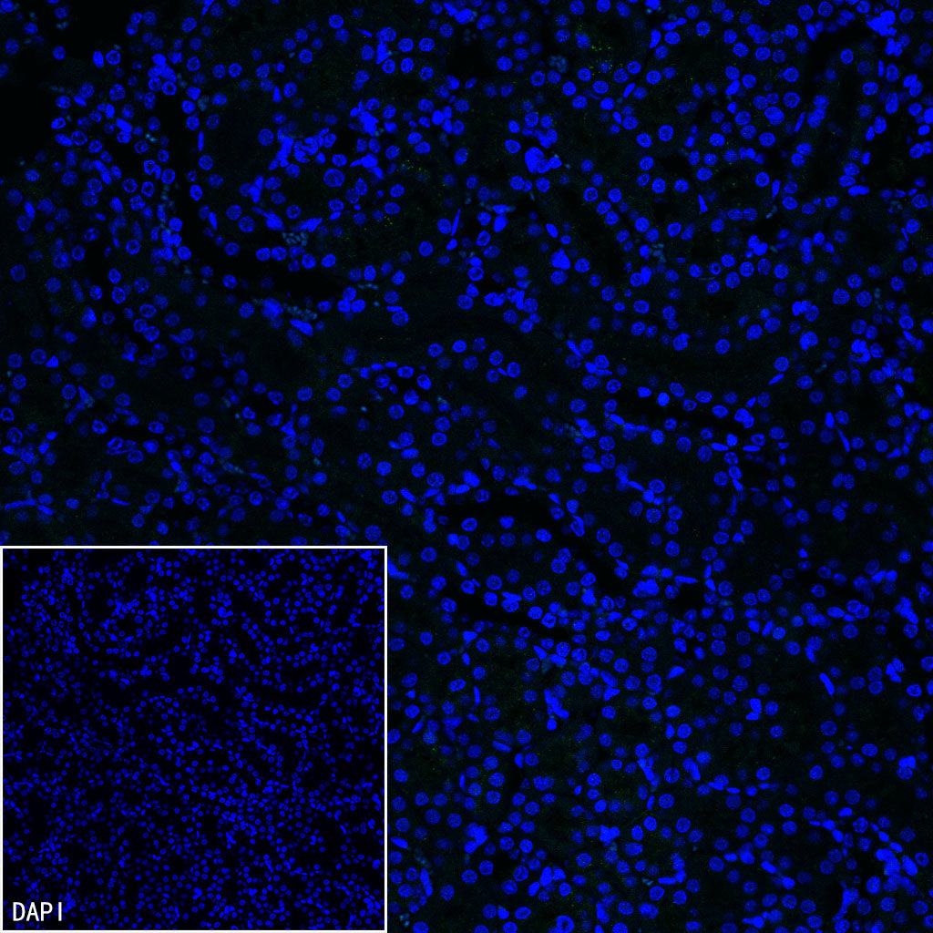 PMP22 Recombinant Rabbit mAb (S-5305)