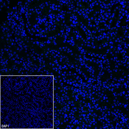 PMP22 Recombinant Rabbit mAb (S-5305)
